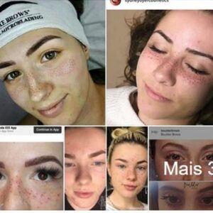 Tatuagens de sarda. Essa é a nova moda?