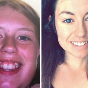 Milagres que um aparelho dentário pode fazer
