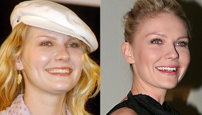 Kirsten-Dunst