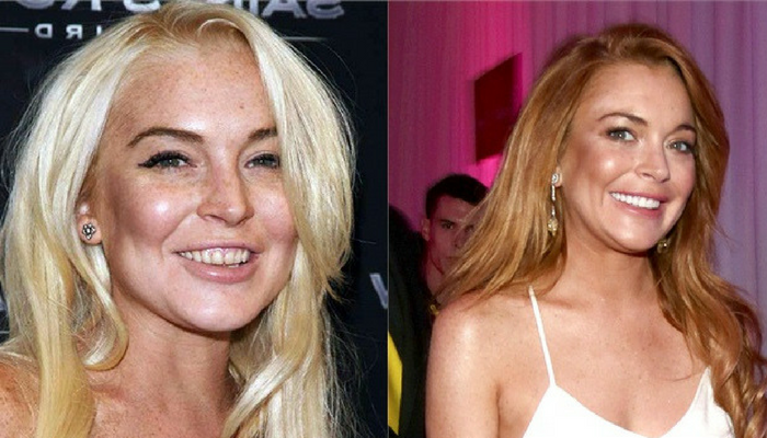 Lindsay-Lohan